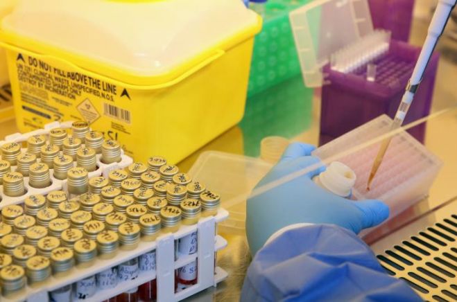 Covid-19: &Mu;&iota;&kappa;&rho;ό&tau;&epsilon;&rho;&omicron;&sigmaf; &omicron; &kappa;ί&nu;&delta;&upsilon;&nu;&omicron;&sigmaf; &epsilon;&pi;&iota;&pi;&lambda;&omicron;&kappa;ώ&nu; &kappa;&alpha;&iota; &theta;&alpha;&nu;ά&tau;&omicron;&upsilon; &gamma;&iota;&alpha; ό&sigma;&omicron;&upsilon;&sigmaf; έ&chi;&omicron;&upsilon;&nu; &epsilon;&pi;&alpha;&rho;&kappa;ή &beta;&iota;&tau;&alpha;&mu;ί&nu;&eta; D