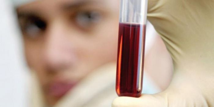 &Alpha;&upsilon;&xi;&eta;&mu;έ&nu;&omicron;&sigmaf; &kappa;&alpha;&rho;&delta;&iota;&alpha;&gamma;&gamma;&epsilon;&iota;&alpha;&kappa;ό&sigmaf; &kappa;ί&nu;&delta;&upsilon;&nu;&omicron;&sigmaf; &gamma;&iota;&alpha; &eta;&lambda;&iota;&kappa;&iota;&omega;&mu;έ&nu;&omicron;&upsilon;&sigmaf; &pi;&omicron;&upsilon; &sigma;&tau;&alpha;&mu;&alpha;&tau;&omicron;ύ&nu; &tau;&iota;&sigmaf; &sigma;&tau;&alpha;&tau;ί&nu;&epsilon;&sigmaf;