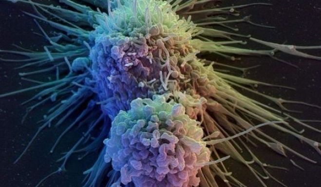 &Nu;έ&alpha; &alpha;&nu;&alpha;&kappa;ά&lambda;&upsilon;&psi;&eta; &delta;&eta;&mu;&iota;&omicron;&upsilon;&rho;&gamma;&epsilon;ί &laquo;&tau;&epsilon;&rho;ά&sigma;&tau;&iota;&epsilon;&sigmaf; &delta;&upsilon;&nu;&alpha;&tau;ό&tau;&eta;&tau;&epsilon;&sigmaf;&raquo; &gamma;&iota;&alpha; &tau;&eta; &theta;&epsilon;&rho;&alpha;&pi;&epsilon;ί&alpha; &kappa;ά&theta;&epsilon; &mu;&omicron;&rho;&phi;ή&sigmaf; &kappa;&alpha;&rho;&kappa;ί&nu;&omicron;&upsilon;